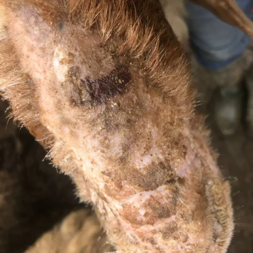 Scabies After Treatment  with DermaCare