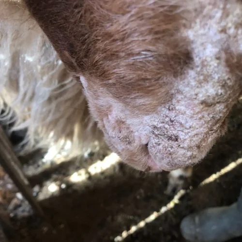 Scabies Before Treatment